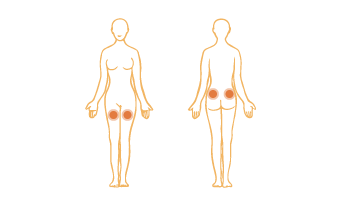 Intramuscular Injection Areas